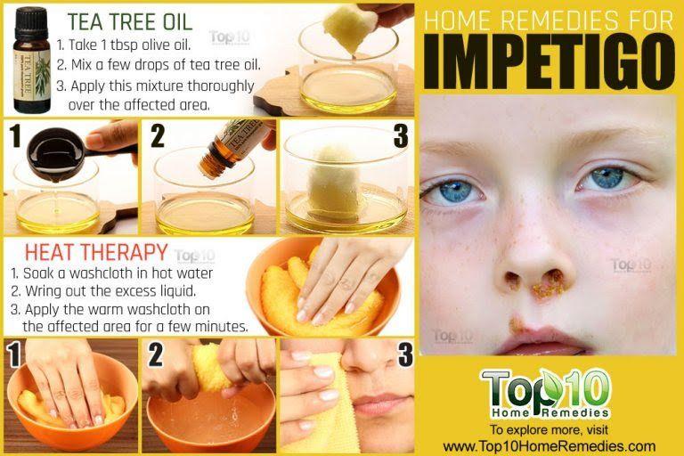 Impetigo Drug