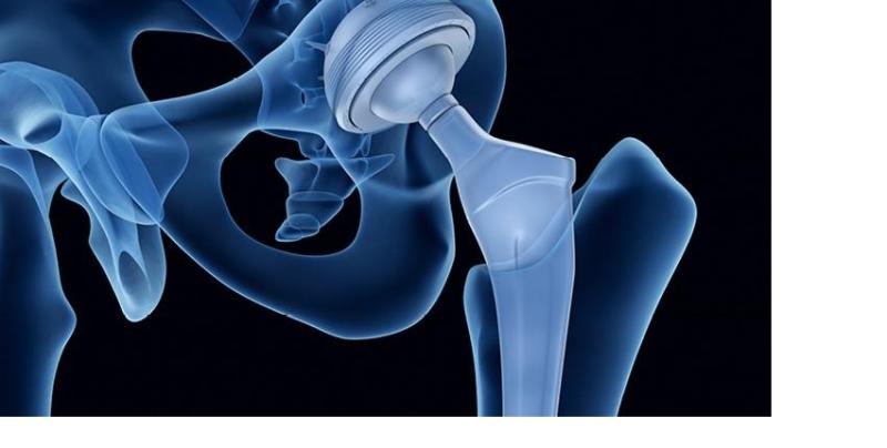 Orthopedic Digit Implants Market
