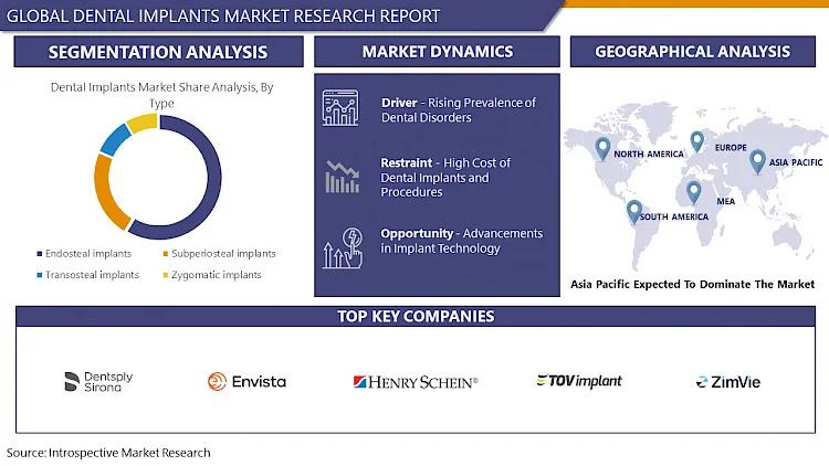 Dental Implants Market is projected to surge ahead at a CAGR