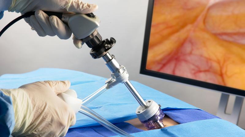 Endoscopic Devices Market