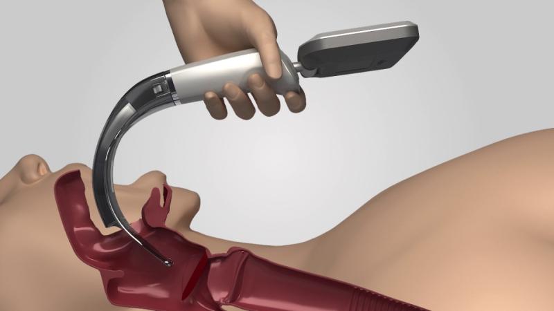 Video Laryngoscope Market