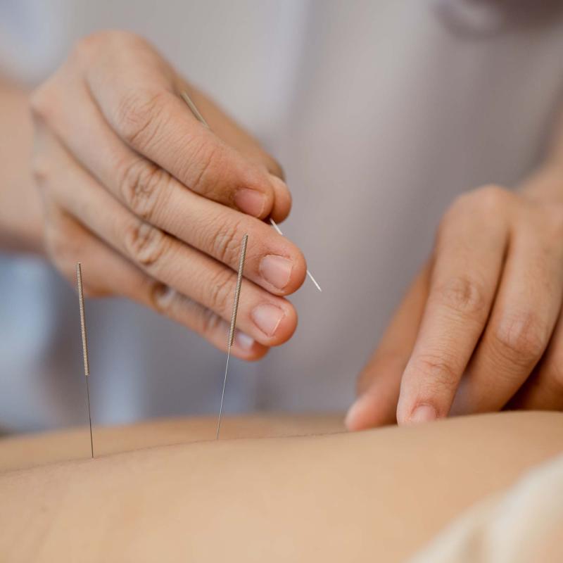 Acupuncture Needles Market