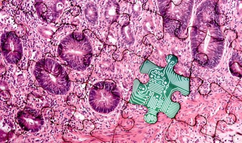 AI in Pathology Market