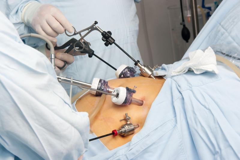 Bariatric Surgery Equipment