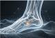 Top China Orthopedic Sports Medicine and Trauma Implant Suppliers for Vietnam's Growing Healthcare Market