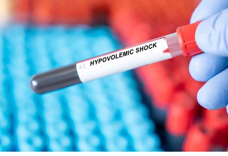 Hypovolemic Shock Market Booming Worldwide With Leading Key