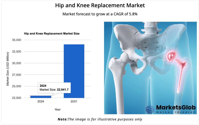 global Hip and Knee Replacement Market Growth Rate 5.8% for 2025-2031, Zimmer Biomet, Johnson & Johnson, Stryker