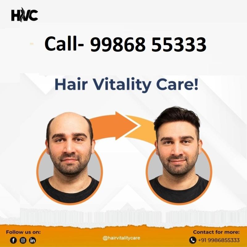 Hair Fixing in Bangalore : Revolutionizing Hair Replacement | HVC