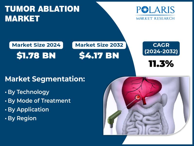 Tumor Ablation Market