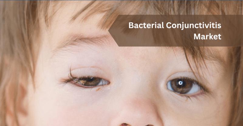 Bacterial Conjunctivitis Market to Reach USD 6,896.0 million by 2032, Growing at a CAGR of 4.33 % says Credence Research