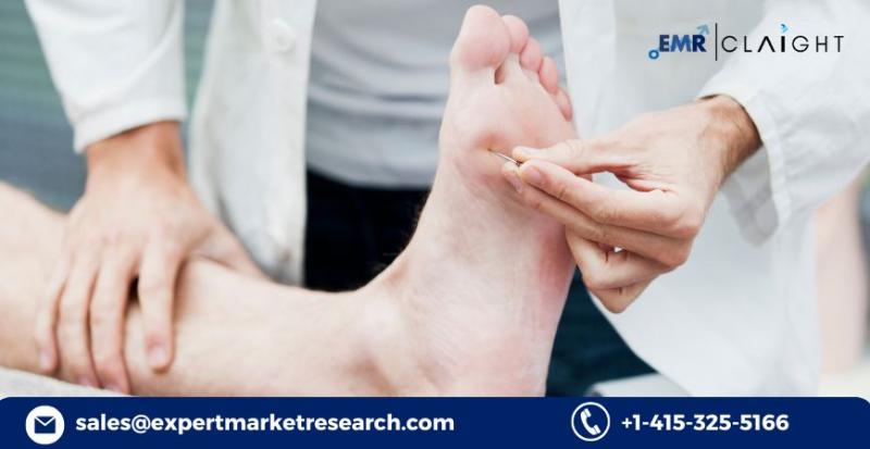 Diabetic Foot Ulcers Market: Market Growth and demand Forecast (2034)