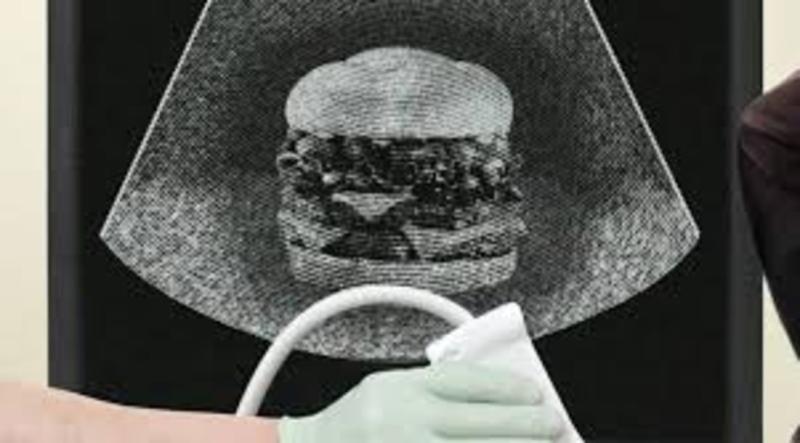 Food Ultrasound Market Merger & Acquisition and R&D Tie-ups | Global Market Ramps Up Toward 2031