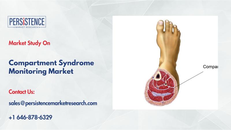 Compartment Syndrome Monitoring Market Growth Driven by Trauma Cases and Surgical Demand