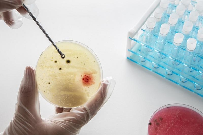 Cell Culture Market Attracts Global Investments Amid Booming Biopharmaceutical Pipeline | Biospherix, Hi-Media Laboratories, Merck KgaA, Promocell GmbH