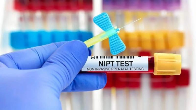 Non-Invasive Prenatal Testing (Nipt) Market