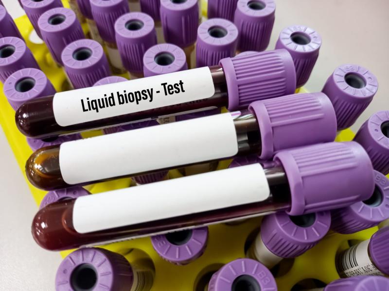 North America Liquid Biopsy Market Fueled by Non-Invasive Cancer Diagnostics and Genomic Insights | Merck & Co, Inc, F. Hoffmann-La Roche AG, Exosome Diagnostics, Inc.
