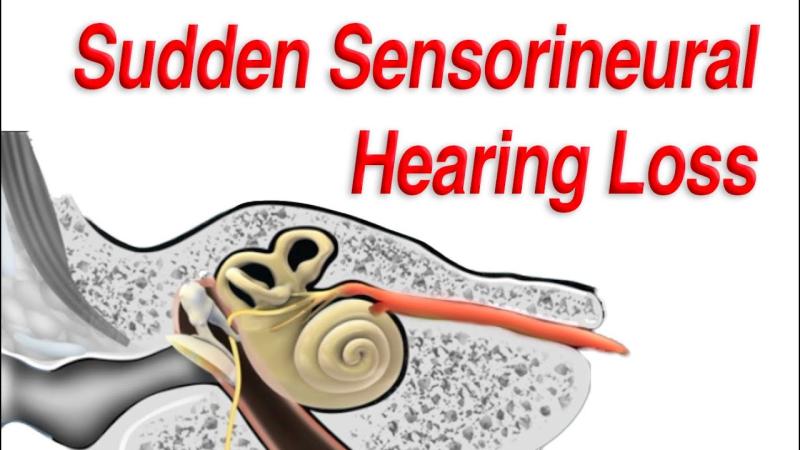 Sudden sensorineural hearing loss Market is expected to reach USD 1.56 billion by 2034