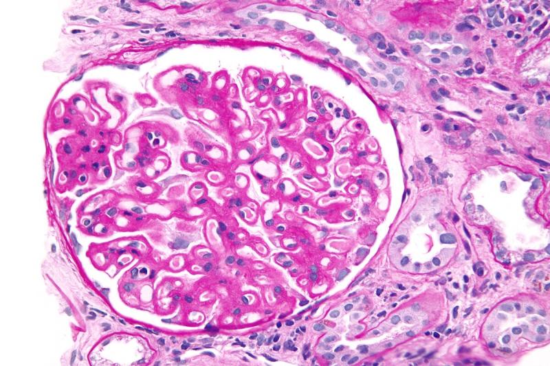 Membranous Nephropathy Market Surges with Novel Anti-PLA2R Therapies & U.S.-Japan Clinical Trials | F. Hoffman La Roche, SynAct Pharma, Roxane Laboratories, Inc, Dr. Reddy's Laboratories Ltd.