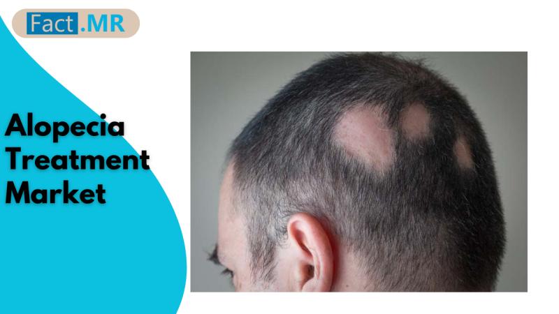 Alopecia Treatment Market in Asia Pacific is Forecasted to Reach USD 5.03 Billion by 2034 | Fact.MR