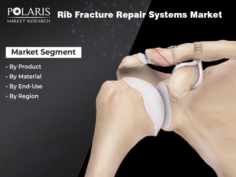 Rib Fracture Repair Systems Market