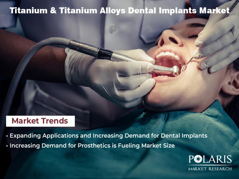 Titanium & Titanium Alloys Dental Implants Market