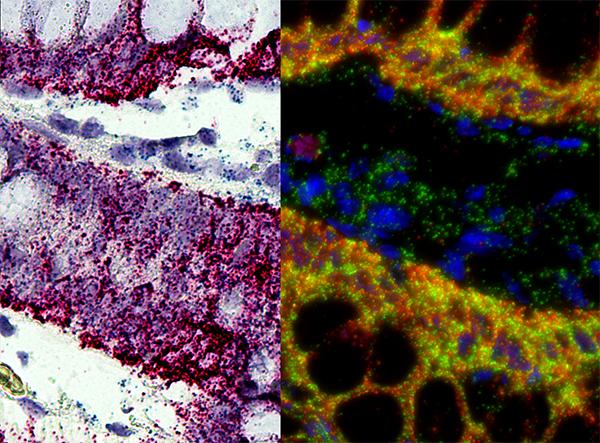 In-Situ Hybridization (ISH) Market Growing Rapidly by - Abbott