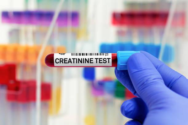 Creatinine Measurement Market Poised for Strong Growth at 12.3% CAGR, Driven by Rising Kidney Disorder Diagnostics | Players: Abbott, Roche, Siemens Healthineers