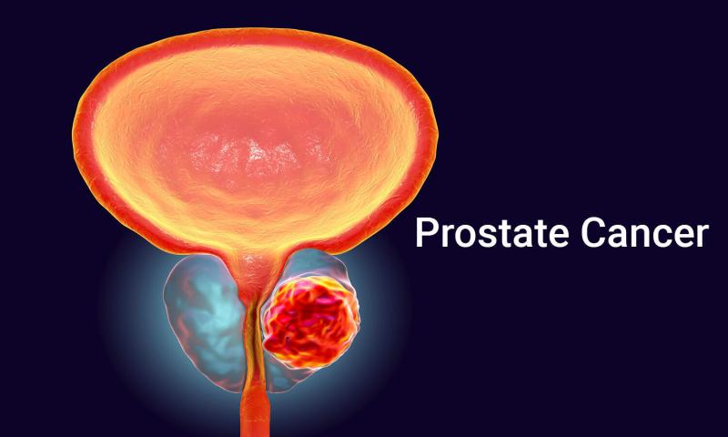 Prostate Cancer Market to Achieve USD 21.6 Billion by 2032, According to DataM Intelligence