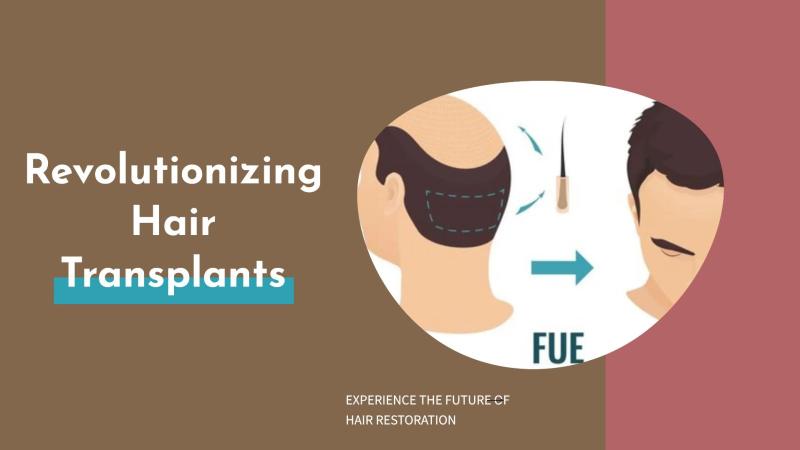 Hair transplant market expected to grow from USD 12.95 billion