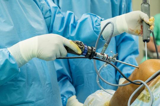 Arthroscopy Devices Market to Grow at 9% CAGR Through 2031, Says DataM Intelligence