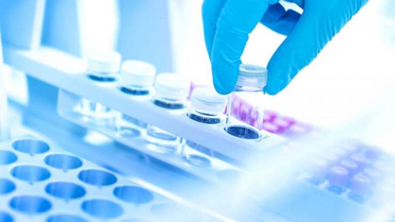 Electrophoresis Reagents Market Booming Worldwide With