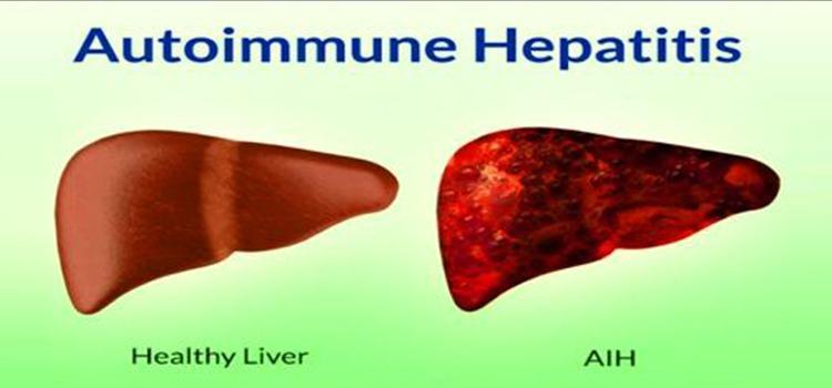 Autoimmune Hepatitis Market to Hit USD 1.92 Billion by 2034
