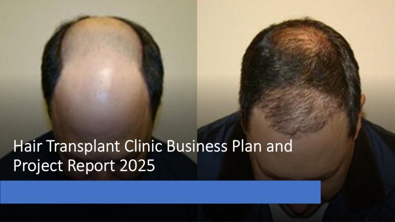Hair Transplant Clinic Project Report 2025: Market Trends and Business Opportunities