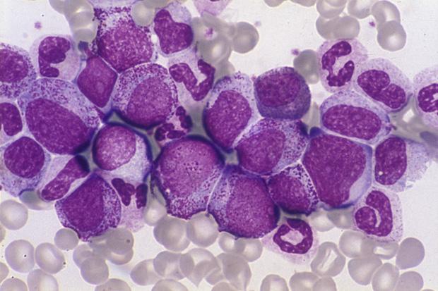 Chronic Phase Chronic Myeloid Leukemia Market is expected to reach USD 18 billion by 2034