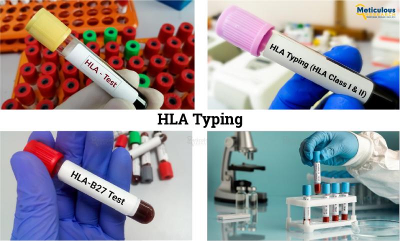 HLA Typing Market to Experience Significant Growth, Reaching