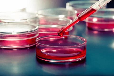 Stem Cell Culture Media Market Size, Trends, Share, Growth and Forecast 2024-2032