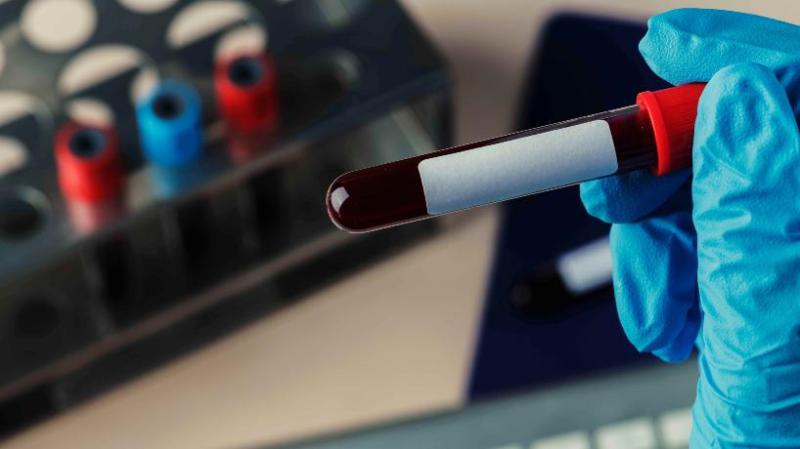 Hematologic Malignancies Testing Market Demand, Growth, Size Industry Outlook Report 2022-2028