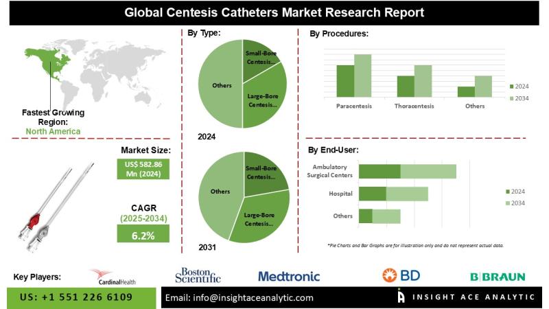 Centesis Catheters Market Demand and Growth Opportunities Detailed Analysis Report 2025-2034