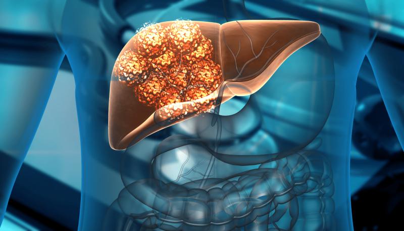 Liver Cancer Therapeutics Market Set to Surge: Innovative Treatments Driving Global Growth and Investment Opportunities 2025 | DataM Intelligence