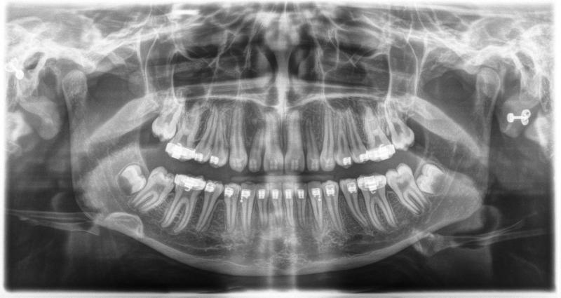 Intraoral Radiography Market Driven by Oral Health Awareness and Cosmetic Dentistry Demand