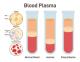 Bovine Blood Plasma Derivatives Market Estimated to Experience a Hike in Growth by 2031