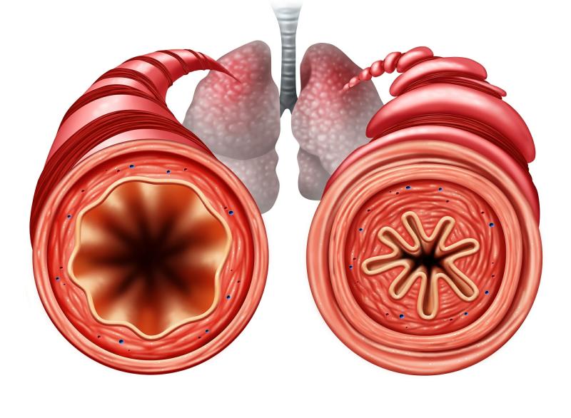 Reactive Airway Disease Market Poised for Robust Growth Amid Rising Respiratory Disorders Worldwide 2025 | Top key players - GlaxoSmithKline Plc., Cipla Ltd, AstraZeneca Plc