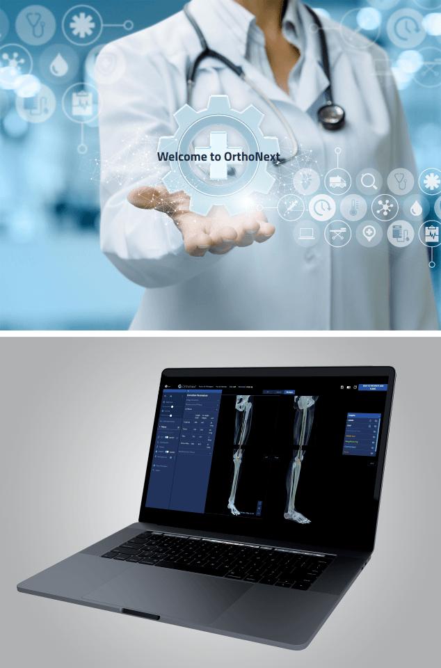 Orthopedic Surgery Software Market Size Future Scope, Demands and Projected Industry Growths to 2033