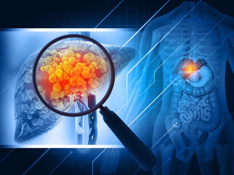 Metabolic Dysfunction-Associated Steatohepatitis (MASH) Treatment Market is expected to reach US$ 7.64 billion by 2031 | Top key players - Madrigal Pharmaceuticals, Simson Pharma Limited, Dr. Reddy's Laboratories Ltd.