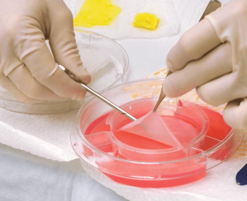 Global Skin Substitutes Market Set for Breakthrough Growth Driven by Innovations in Regenerative Medicine 2025 | Top key players - Organogenesis, Inc, Acelity L.P., Inc, Smith & Nephew plc.