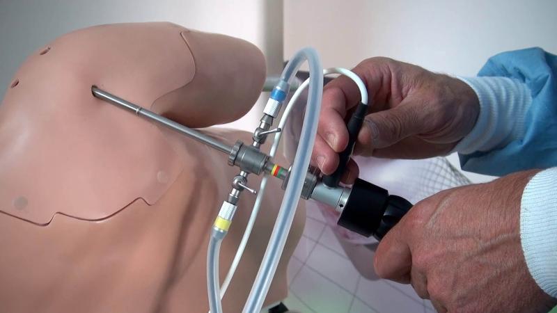 Arthroscopy Devices Market Poised for Robust Growth Amid Rising Demand for Minimally Invasive Surgery 2025 | Top key players - Arthrex, Smith+Nephew, Stryker, Medtronic.