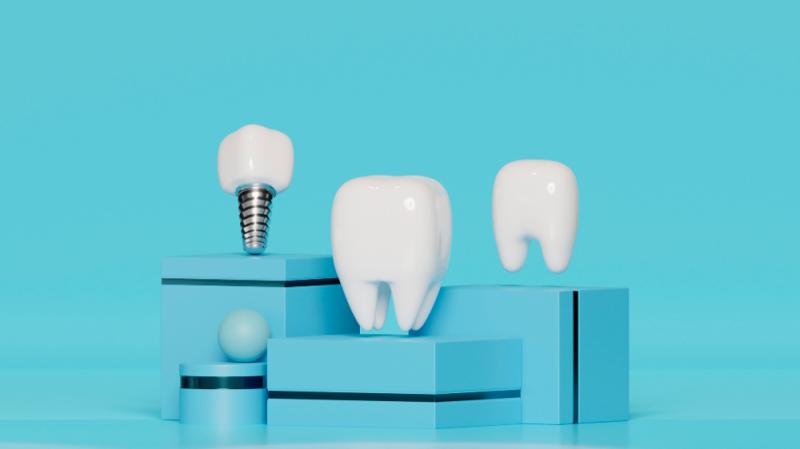 India Dental Implants Market Size, Share, Growth Trends, Analysis & Industry Outlook 2025-2033