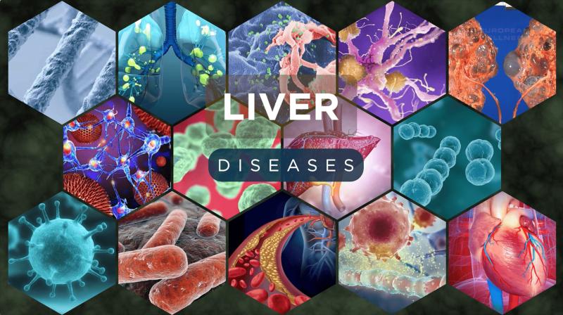 Liver Disease Treatment Europe Market, Industry Trends | Top 5 Companies - Intercept Pharmaceuticals, Vertex Pharmaceuticals, Allergan (now part of AbbVie), Novartis, Johnson & Johnson