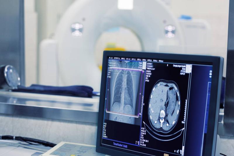 Europe Medical Imaging Market Advances with AI-Powered Diagnostics, Aging Population & Rising Demand for Early Disease Detection | Key Companies: Siemens Healthineers, Philips Healthcare, GE Healthcare, Canon Medical Systems, Fujifilm Medical Systems