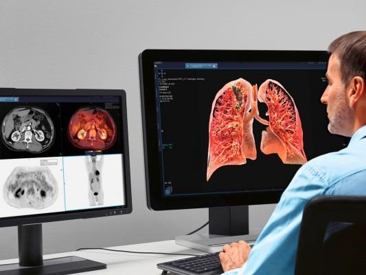 Computer Aided Detection Market : A Study of the Industry's Key Applications and Technologies